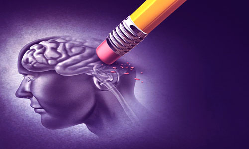 هر آنچه باید درمورد آلزایمر بدانید